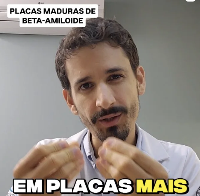 Publicação em vídeo sobre placas maduras de beta-amiloide